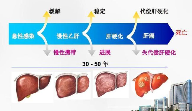 肝癌攻克最新進(jìn)展，科研突破、未來(lái)展望與希望之光